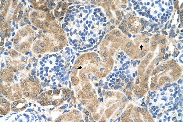 TM9SF1 antibody LS-C40490 IHC of formalin-fixed, paraffin-embedded human Kidney. Positive label: Epithelial cells of renal tubule indicated with arrows. Antibody concentration 4-8 ug/ml. Magnification 400X.
