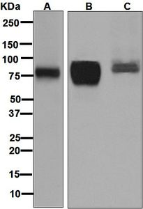Western blot analysis on (A) HT-29, (B) HT-1376, and (C) Caco-2 cell lysates using anti-TPBG antibody.