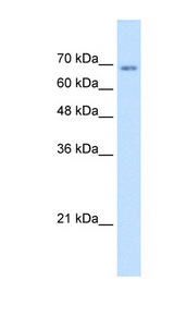 TM9SF1 antibody LS-C40490 Western blot of Jurkat lysate.