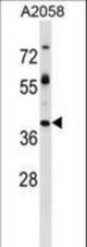 TPBG Antibody western blot of A2058 cell line lysates (35 ug/lane). The TPBG antibody detected the TPBG protein (arrow).