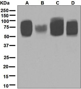 Western blot analysis on (A) HT-1376, (B) HeLa, (C) JAR, and (D) MCF-7 cell lysates using anti-TPBG antibody.