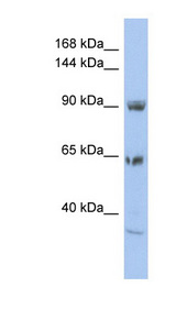 TPCN1 antibody LS-C110014 Western blot of HT1080 cell lysate.