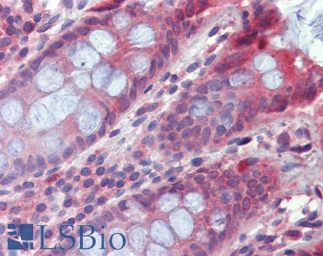 Anti-TPCN2 antibody IHC of human colon. Immunohistochemistry of formalin-fixed, paraffin-embedded tissue after heat-induced antigen retrieval. Antibody LS-B4183 concentration 3.75 ug/ml.