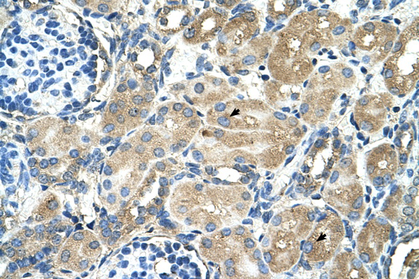 TM9SF1 antibody LS-C40491 IHC of formalin-fixed, paraffin-embedded human Kidney. Positive label: Epithelial cells of renal tubule indicated with arrows. Antibody concentration 4-8 ug/ml. Magnification 400X.
