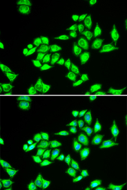 Immunofluorescence analysis of U2OS cell using TPD52L1 antibody. Blue: DAPI for nuclear staining.