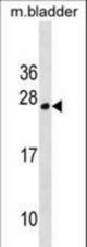 TPD52L1 Antibody western blot of mouse bladder tissue lysates (35 ug/lane). The TPD52L1 antibody detected the TPD52L1 protein (arrow).