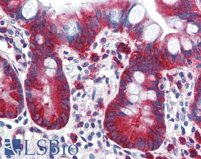 Anti-TPD52L1 antibody IHC of human small intestine. Immunohistochemistry of formalin-fixed, paraffin-embedded tissue after heat-induced antigen retrieval. Antibody LS-B2920 concentration 5 ug/ml.