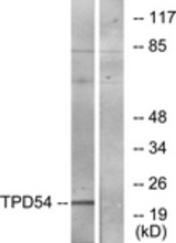Western blot of extracts from Jurkat cells, using TPD54 Antibody. The lane on the right is treated with the synthesized peptide.