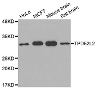 Western blot analysis of extracts of various cell lines, using TPD52L2 antibody.