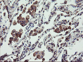 IHC of paraffin-embedded Human lung tissue using anti-TPD52L3 mouse monoclonal antibody.