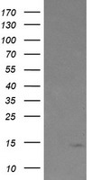 HEK293T cells were transfected with the pCMV6-ENTRY control (Left lane) or pCMV6-ENTRY TPD52L3 (Right lane) cDNA for 48 hrs and lysed. Equivalent amounts of cell lysates (5 ug per lane) were separated by SDS-PAGE and immunoblotted with anti-TPD52L3.