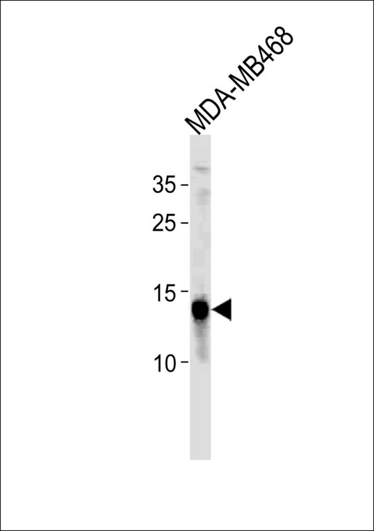 TPD52L3 Antibody western blot of MDA-MB468 cell line lysates (35 ug/lane). The TPD52L3 antibody detected the TPD52L3 protein (arrow).