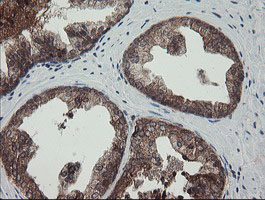 IHC of paraffin-embedded Human prostate tissue using anti-TPD52L3 mouse monoclonal antibody.