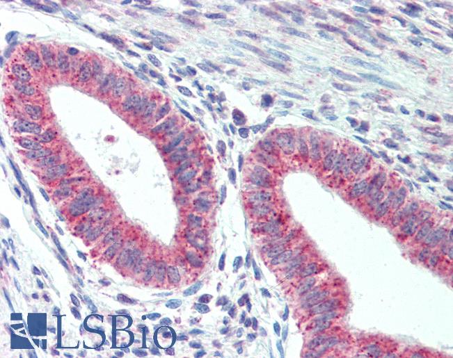 Anti-TM9SF1 antibody LS-A9225 IHC of human uterus. Immunohistochemistry of formalin-fixed, paraffin-embedded tissue after heat-induced antigen retrieval.
