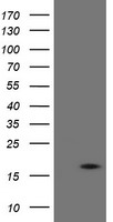 HEK293T cells were transfected with the pCMV6-ENTRY control (Left lane) or pCMV6-ENTRY TPD52L3 (Right lane) cDNA for 48 hrs and lysed. Equivalent amounts of cell lysates (5 ug per lane) were separated by SDS-PAGE and immunoblotted with anti-TPD52L3.