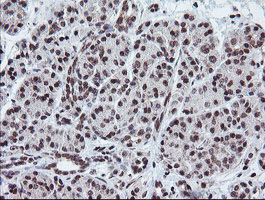 IHC of paraffin-embedded Human pancreas tissue using anti-TPD52L3 mouse monoclonal antibody. (Heat-induced epitope retrieval by 10mM citric buffer, pH6.0, 120°C for 3min).