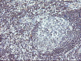 IHC of paraffin-embedded Human tonsil using anti-TPD52L3 mouse monoclonal antibody. (Heat-induced epitope retrieval by 10mM citric buffer, pH6.0, 120°C for 3min).