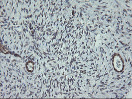IHC of paraffin-embedded Human Ovary tissue using anti-TPD52L3 mouse monoclonal antibody. (Heat-induced epitope retrieval by 10mM citric buffer, pH6.0, 120°C for 3min).