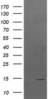 HEK293T cells were transfected with the pCMV6-ENTRY control (Left lane) or pCMV6-ENTRY TPD52L3 (Right lane) cDNA for 48 hrs and lysed. Equivalent amounts of cell lysates (5 ug per lane) were separated by SDS-PAGE and immunoblotted with anti-TPD52L3.