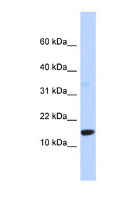 TPD52L3 antibody LS-C112240 Western blot of 293T cell lysate.