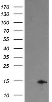 HEK293T cells were transfected with the pCMV6-ENTRY control (Left lane) or pCMV6-ENTRY TPD52L3 (Right lane) cDNA for 48 hrs and lysed. Equivalent amounts of cell lysates (5 ug per lane) were separated by SDS-PAGE and immunoblotted with anti-TPD52L3.