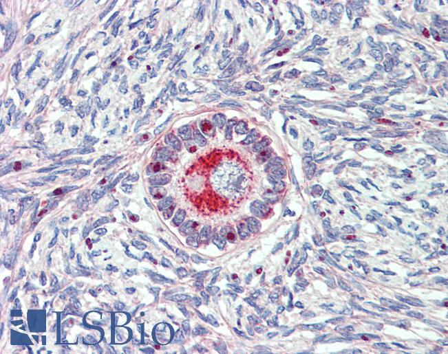 Anti-TM9SF1 antibody LS-A9225 IHC of human ovary. Immunohistochemistry of formalin-fixed, paraffin-embedded tissue after heat-induced antigen retrieval.