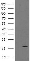 HEK293T cells were transfected with the pCMV6-ENTRY control (Left lane) or pCMV6-ENTRY TPD52L3 (Right lane) cDNA for 48 hrs and lysed. Equivalent amounts of cell lysates (5 ug per lane) were separated by SDS-PAGE and immunoblotted with anti-TPD52L3.