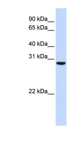 C18orf10 antibody LS-C102608 Western blot of Fetal Muscle lysate.