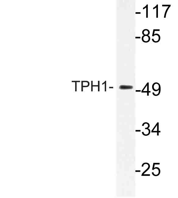 Western blot of TPH1 (V256) pAb in extracts from Jurkat cells.