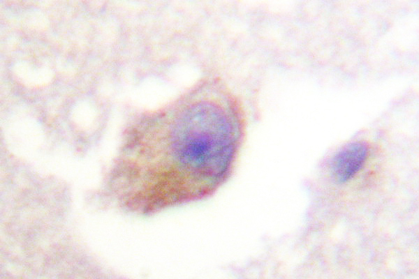 IHC of TPH1 (K54) pAb in paraffin-embedded human brain tissue.