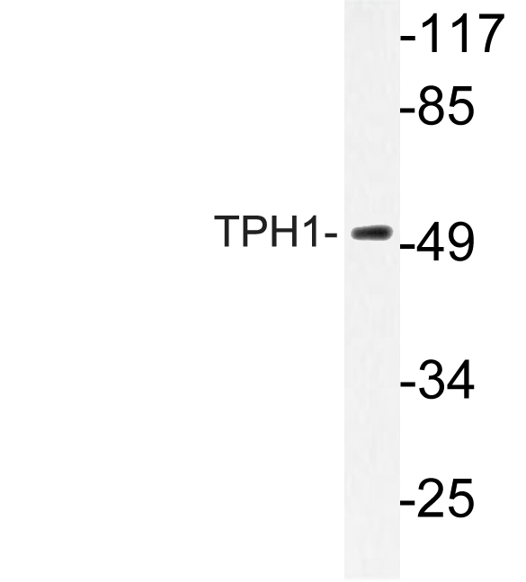 Western blot of TPH1 (K54) pAb in extracts from HepG2 cells.