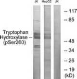 Western blot of extracts from Jurkat cells and HepG2 cells, using Tryptophan Hydroxylase (Phospho-Ser260) Antibody. The lane on the right was incubated with synthetic peptide.