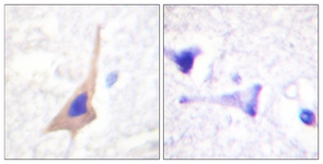 IHC of paraffin-embedded human brain, using Tryptophan Hydroxylase (Phospho-Ser58) Antibody. The sample on the right was incubated with synthetic peptide.