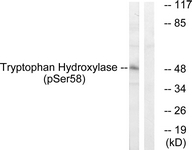 Western blot of extracts from 293 cells treated with paclitaxel 1uM 24h, using Tryptophan Hydroxylase (Phospho-Ser58) Antibody. The lane on the right was incubated with synthetic peptide.
