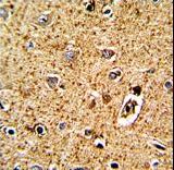 Formalin-fixed and paraffin-embedded human brain tissue with TPH1 Antibody , which was peroxidase-conjugated to the secondary antibody, followed by DAB staining. This data demonstrates the use of this antibody for immunohistochemistry; clinical relevance has not been evaluated.
