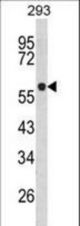 Western blot of TPH1 Antibody in 293 cell line lysates (35 ug/lane). TPH1 (arrow) was detected using the purified antibody.