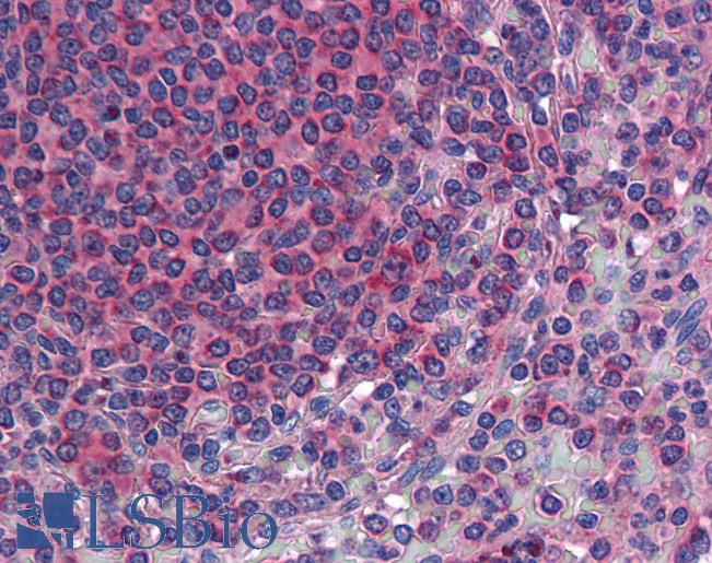 Anti-TM9SF3 antibody LS-A8168 IHC of human spleen. Immunohistochemistry of formalin-fixed, paraffin-embedded tissue after heat-induced antigen retrieval.