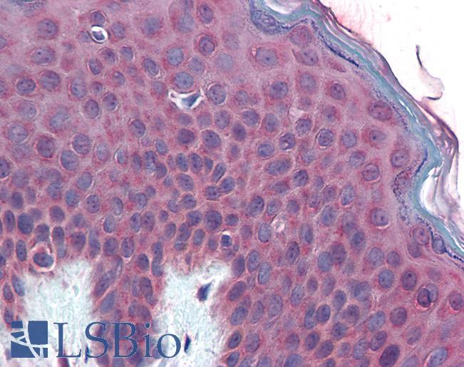 Anti-TM9SF3 antibody LS-A8168 IHC of human skin. Immunohistochemistry of formalin-fixed, paraffin-embedded tissue after heat-induced antigen retrieval.
