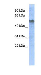 TPH2 antibody LS-C109867 Western blot of Fetal Brain lysate.