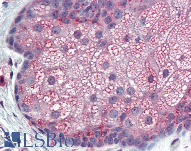 Anti-TM9SF3 antibody IHC of skin, sebaceous gland, human. Immunohistochemistry of formalin-fixed, paraffin-embedded tissue after heat-induced antigen retrieval. Antibody LS-A8165 dilution 10 ug/ml.