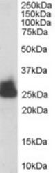 Antibody staining (0.003 ug/ml) of human liver lysate (RIPA buffer, 30 ug total protein per lane). Primary incubated for 1 hour. Detected by Western blot of chemiluminescence.
