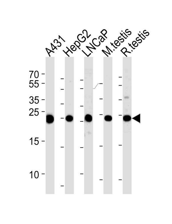 Western blot of lysates from A431, HepG2, LNCaP cell line and mouse testis, rat testis tissue lysates (from left to right), using TPI1 Antibody. Antibody was diluted at 1:1000 at each lane.A goat anti-rabbit IgG H&L (HRP) at 1:5000 dilution was used as the secondary antibody. Lysate at 35ug per lane.