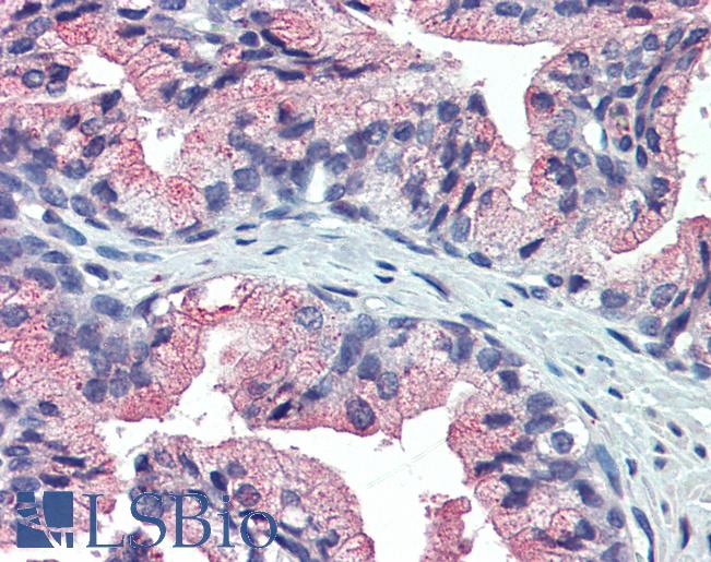 Anti-TM9SF3 antibody IHC of prostate, human. Immunohistochemistry of formalin-fixed, paraffin-embedded tissue after heat-induced antigen retrieval. Antibody LS-A8165 dilution 10 ug/ml.