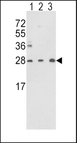 Western blot of TPI1 Antibody in Y79(lane 1),CEM(lane 2) cell line and mouse brain tissue(lane 3) lysates (35 ug/lane). TPI1 (arrow) was detected using the purified antibody.(2 ug/ml)