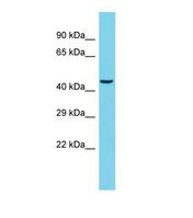 Western blot of Human Rat Pancreas. Tm9sf3 antibody dilution 1.0 ug/ml.
