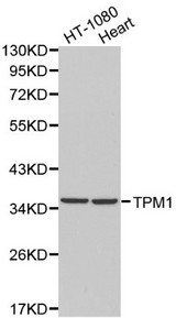 Western blot of TPM1 pAb in extracts from HT-1080 cells and mouse heart tissue.