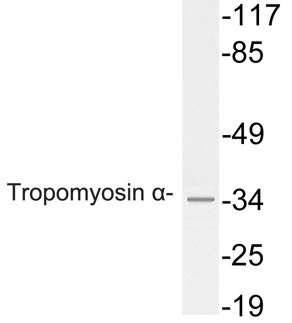 Western blot of Tropomyosin alpha antibody in extracts from HeLa cells.