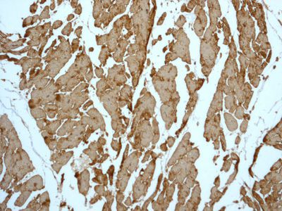 IHC of paraffin-embedded human muscle tissue using anti-Tropomyosin-1/3 antibody.