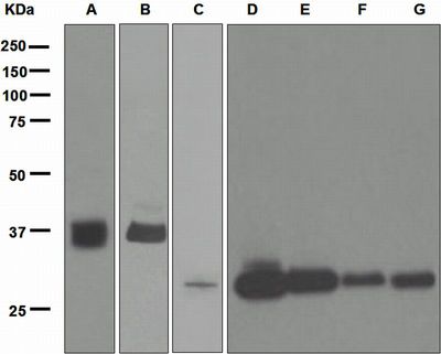 Western blot analysis on (A) Human skeletal muscle, (B) Human heart, (C) HUVEC, (D) C6, (E) Raw264.7, (F) PC-12, and (G) NIH/3T3 cell lysates using anti-Tropomyosin-1/3 antibody.