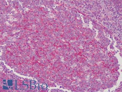 Anti-Tropomyosin 1 antibody IHC of human tonsil. Immunohistochemistry of formalin-fixed, paraffin-embedded tissue after heat-induced antigen retrieval. Antibody LS-B4800 concentration 10 ug/ml.